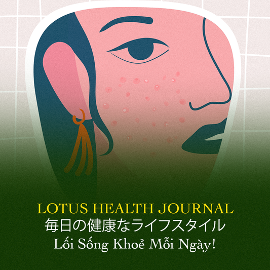 Lotus Health Journal #5 - LỖ CHÂN LÔNG TO – KHI LÀN DA LÊN TIẾNG VỀ TUỔI XUÂN BỊ ĐÁNH CẮP